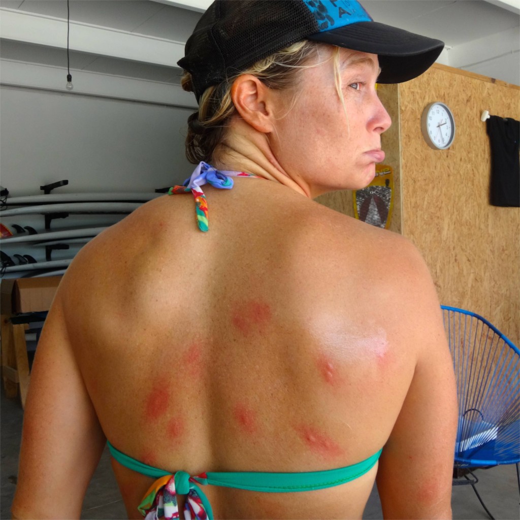The mosquitos and jelly fish were relentless. Walking back through the jungle after surfing one day, I was attacked. A friend counted more than 30 bites. They itched for days.